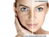 BEST TREATMENT FOR DARK SPOT