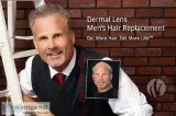Men&rsquos Hair Replacement Dallas Fort Worth Texas