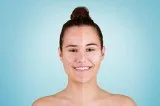 Safe and Secure Rosacea Treatment in Calgary
