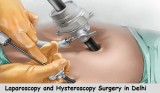 Laparoscopy Surgery Cost in Delhi