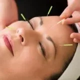 Chinese Acupuncture Training