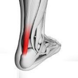 Toenail Fungus Laser Treatment Podiatry Physician Brooklyn NY