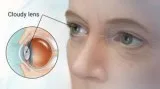 Dr. Leo Ayzenberg MD Eye Clinic Optical Boutique Eye Surgery Cli