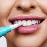 Find Teeth whitening in Gilbert AZ- SofTouch Dental Care