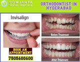 Orthodontist in Hyderabad- Popular Doctors in Hyderabad