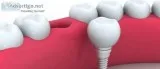 Holistic Dental Brunswick - Affordable Dental Implants Melbourne