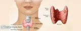 Thyroid Ayurvedic Clinic-Dr.Digish(M.D Ayu)Best Ayurvedic Doctor