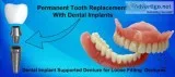 Choose  best dental implant clinic in kolkata to solve your dent