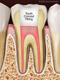 Save Your Natural Tooth With Root Canal Treatment in Guelph