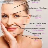 Premier Face Lift Treatment  Ppsofne.com