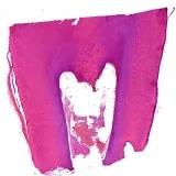 Searching for the Oral Pathology residents services in Delhi NCR