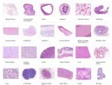 Looking for the Best Digital Pathology solutions services in Del