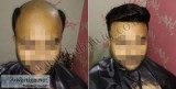 Hair Wigs in Delhi India