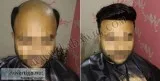 Hair Wigs in Delhi India