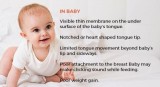 Day Wetting Treatment In Melbourne