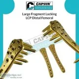 Large Fragment Implants Manufacturer