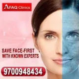 Best skin treatment with affordable cost and guaranteed result