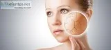 Say Bye to Your Skin Dryness