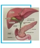 Laparoscopic gallbladder removal surgery