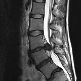 Facing Spine Issues Contact Spine Specialist in Melbourne Today