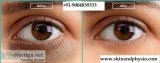UNDER EYES DARK CIRCLES