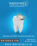 Dentist in Gurgaon  Dental implants in Gurgaon
