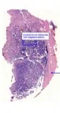 Histopathology slides services in Delhi India