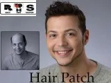 Hair Transplant Cost  Hair Restoration