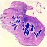 Digital Cytology slides slide services in Delhi India