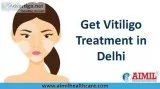 Vitiligo Treatment in Delhi