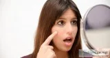 How To Get Rid Of Dark Circles