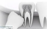 BEST MINOR ORAL SURGERY and MEDICAL EMERGENCIES COURSE IN HYDERA