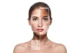 Affordable Laser Treatment for Face