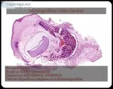 Best Histopathology slides services in Delhi  India