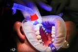 Immediate Dentures Longmont