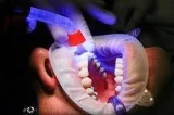 Immediate Dentures Longmont