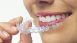 Order Online Invisible Aligners in Anaheim