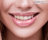 Zirconia Crown Treatment Highland  Smilesbygentledental .com