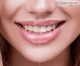 Zirconia Crown Treatment Highland  Smilesbygentledental .com