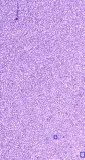 Find the Best Hematology slides online services in Delhi NCR Ind