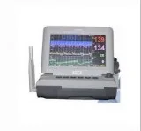 fetal monitor