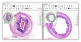 Looking for the Best Non Gynae Cytology Slides online services i
