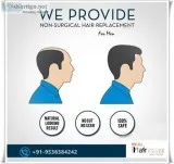Hair Patch in Gurgaon