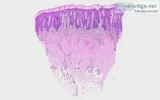 Dermatopathology slides