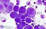 Looking for the Best Cytology slides online services in Delhi NC