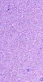 Searching for the Best Hematology slides online services in Delh