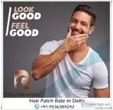 Hair Patch in Delhi