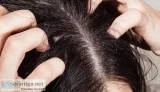 SMUK Provide Best Dandruff Treatment in India