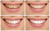 Oral Dental Implants Westwood