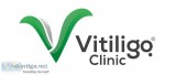 Vitiligo clinic  vitiligo consultation in usa